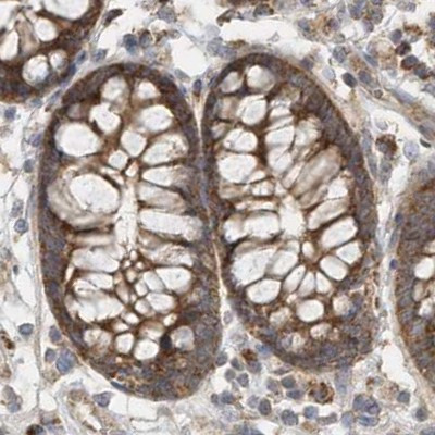 MUT Antibody in Immunohistochemistry (IHC)