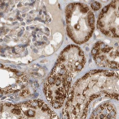 MUT Antibody in Immunohistochemistry (IHC)