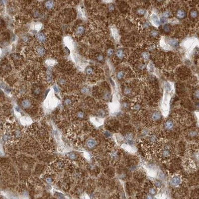 MUT Antibody in Immunohistochemistry (IHC)