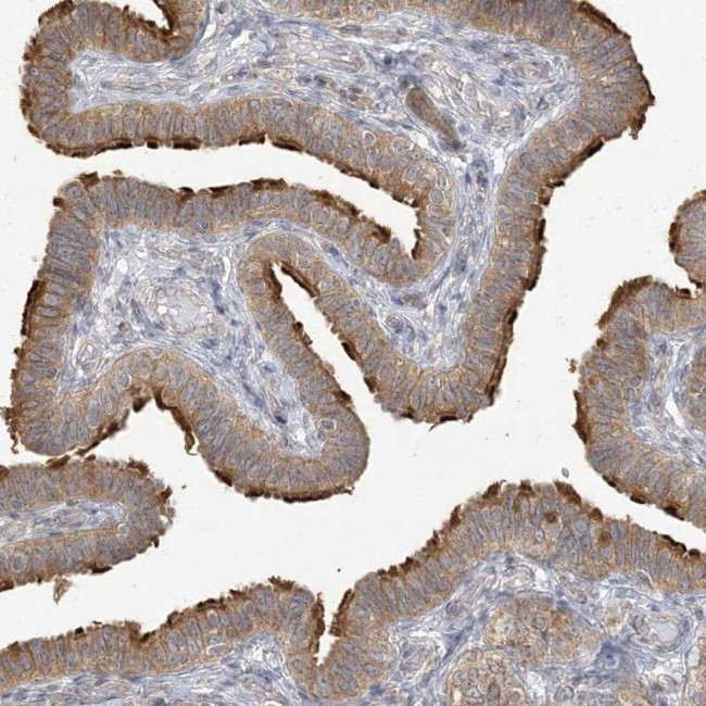 ZC3H6 Antibody in Immunohistochemistry (IHC)