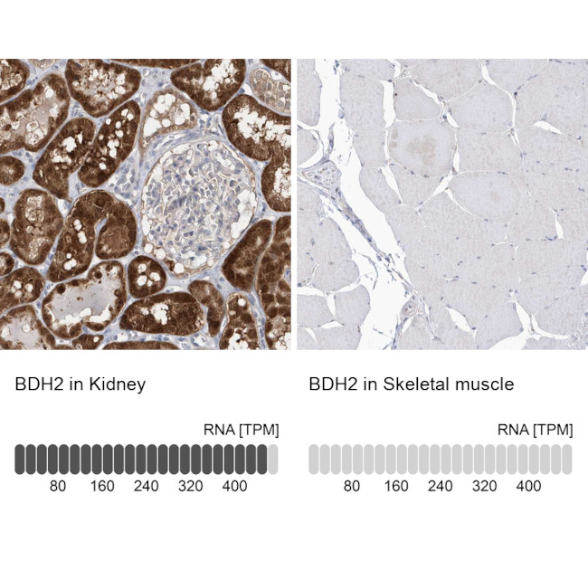 BDH2 Antibody in Immunohistochemistry (IHC)