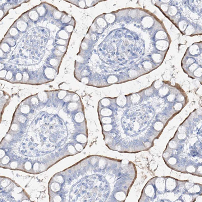 SLC26A3 Antibody in Immunohistochemistry (IHC)