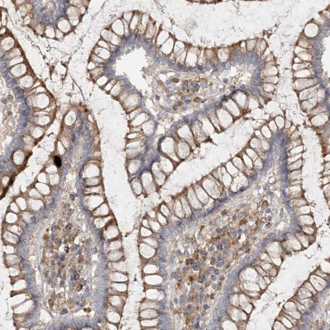 SPPL2A Antibody in Immunohistochemistry (IHC)