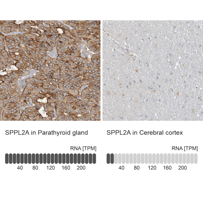 SPPL2A Antibody