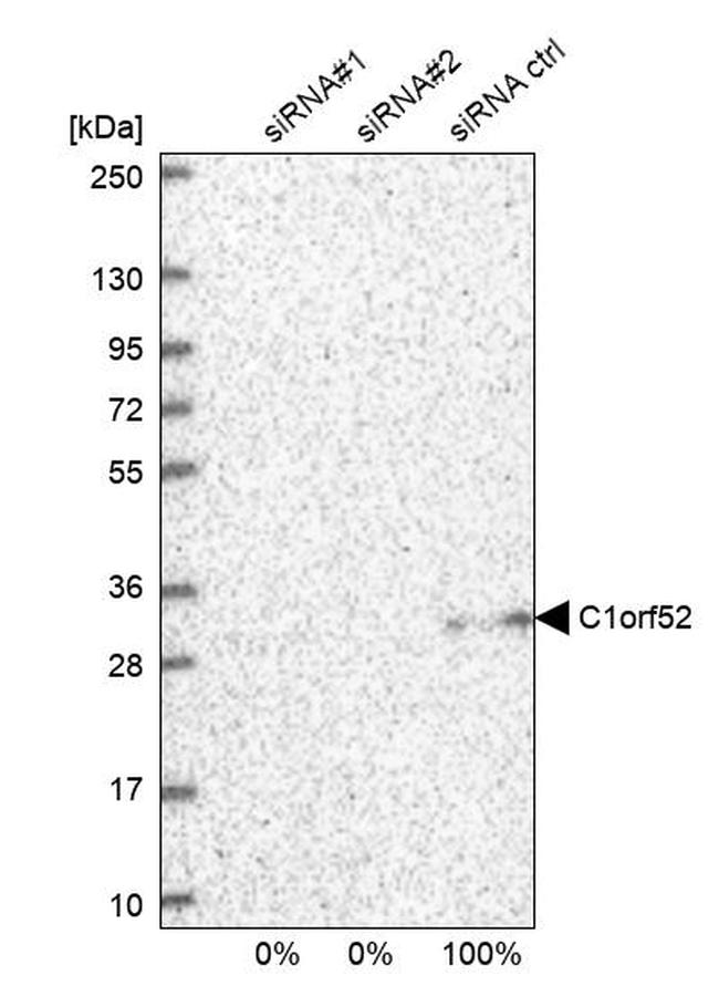 CA052 Antibody in Western Blot (WB)