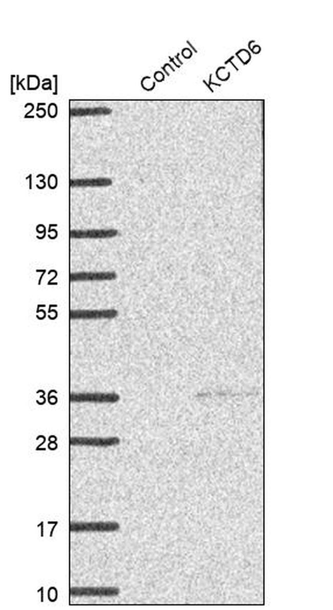 KCTD6 Antibody in Western Blot (WB)