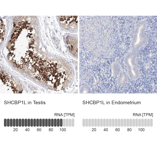 SHCBP1L Antibody in Immunohistochemistry (IHC)