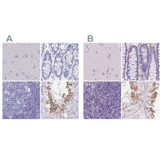 SHCBP1L Antibody in Immunohistochemistry (IHC)