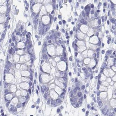 SHCBP1L Antibody in Immunohistochemistry (IHC)