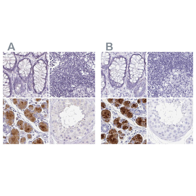 PRR27 Antibody in Immunohistochemistry (IHC)