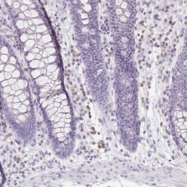 PRR27 Antibody in Immunohistochemistry (IHC)