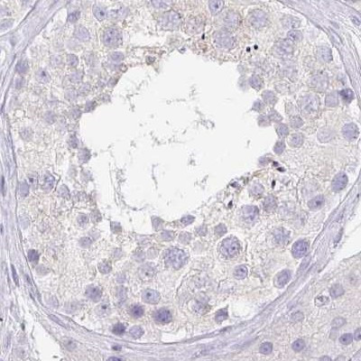 PRR27 Antibody in Immunohistochemistry (IHC)