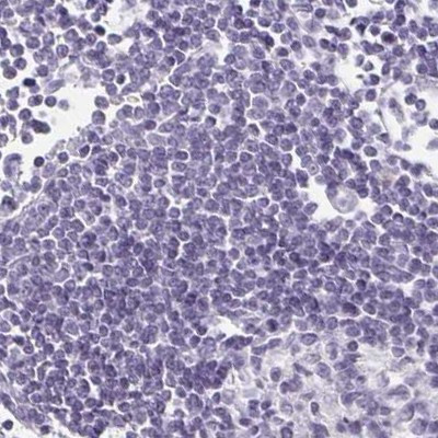 PRR27 Antibody in Immunohistochemistry (IHC)