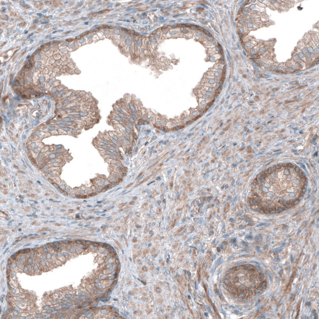 UMPS Antibody in Immunohistochemistry (IHC)