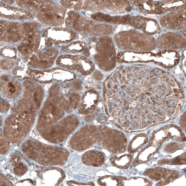 UMPS Antibody in Immunohistochemistry (IHC)