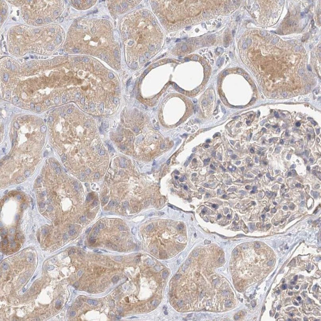 UMPS Antibody in Immunohistochemistry (IHC)