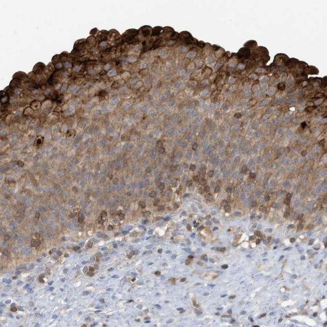 NSUN3 Antibody in Immunohistochemistry (IHC)