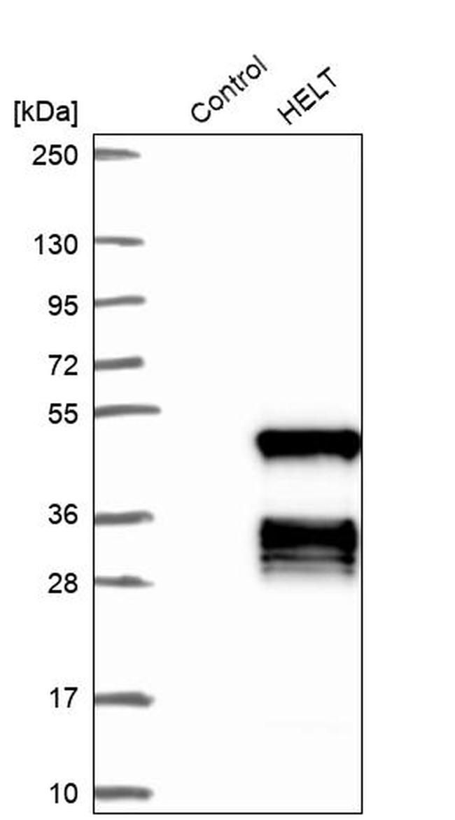 HELT Antibody in Western Blot (WB)