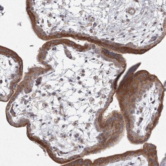 WDR49 Antibody in Immunohistochemistry (IHC)