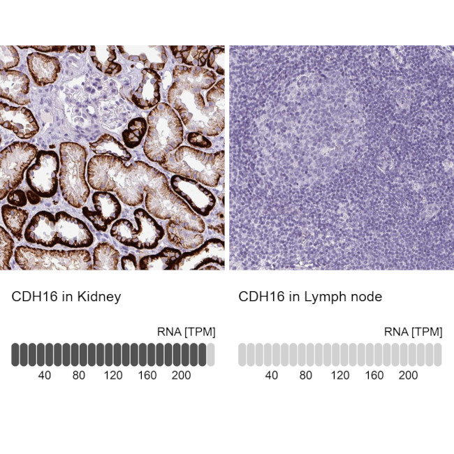 CDH16 Antibody in Immunohistochemistry (IHC)