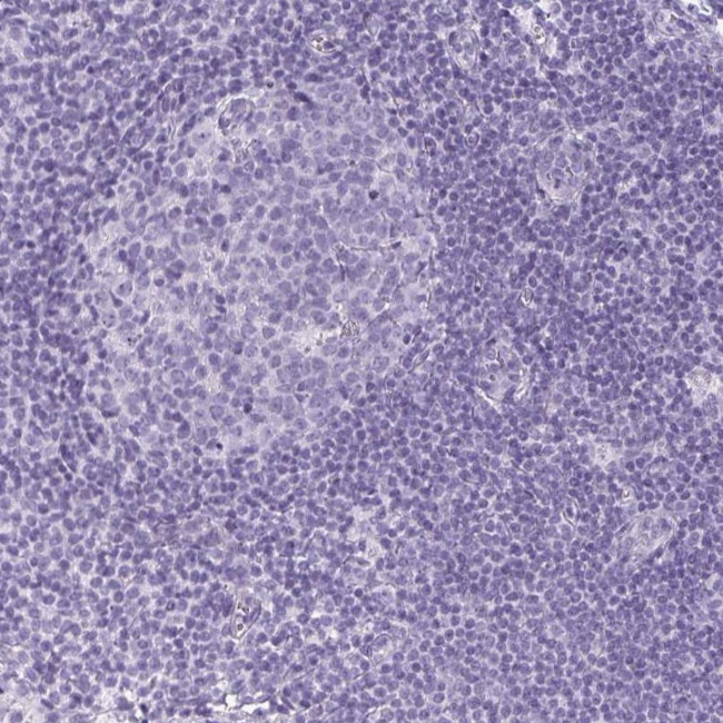 CDH16 Antibody in Immunohistochemistry (IHC)