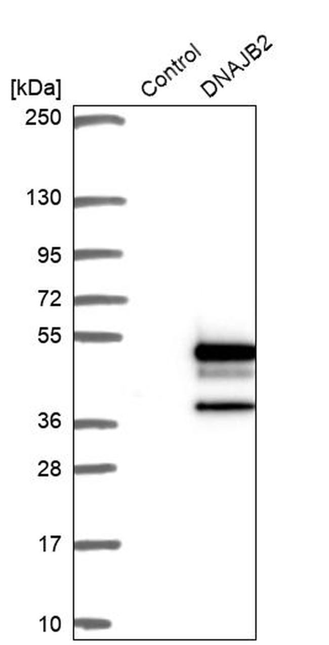 DNAJB2 Antibody in Western Blot (WB)