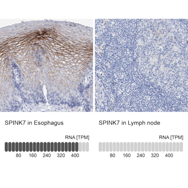 SPINK7 Antibody in Immunohistochemistry (IHC)