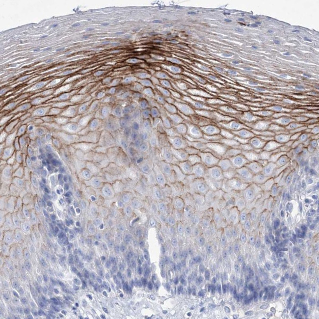 SPINK7 Antibody in Immunohistochemistry (IHC)