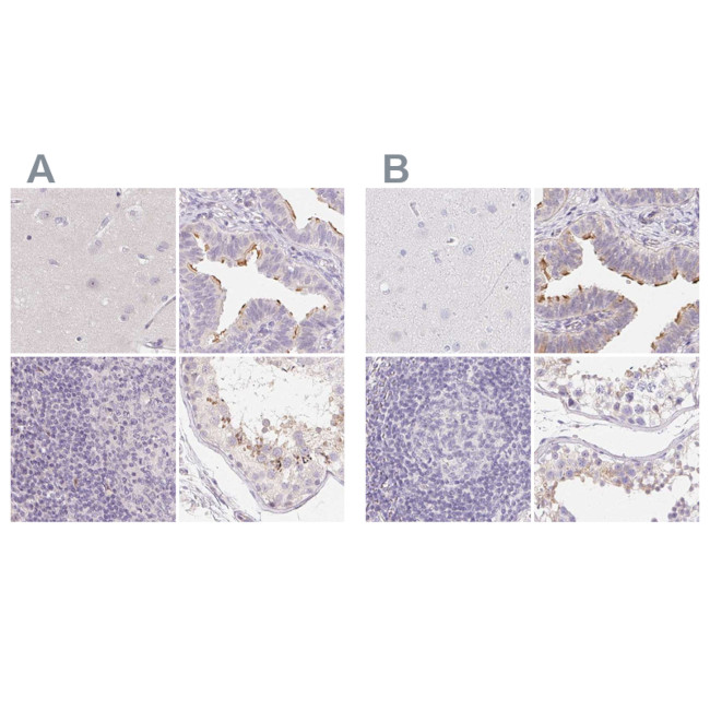 ZBBX Antibody in Immunohistochemistry (IHC)