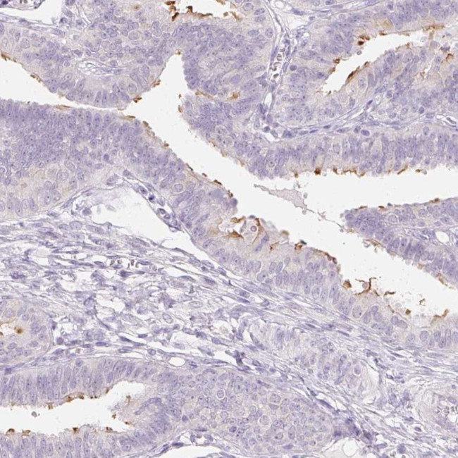 ZBBX Antibody in Immunohistochemistry (IHC)