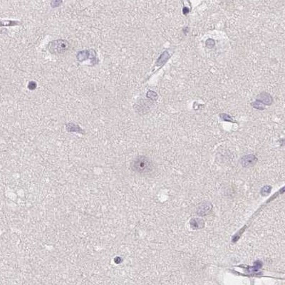 ZBBX Antibody in Immunohistochemistry (IHC)