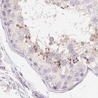 ZBBX Antibody in Immunohistochemistry (IHC)