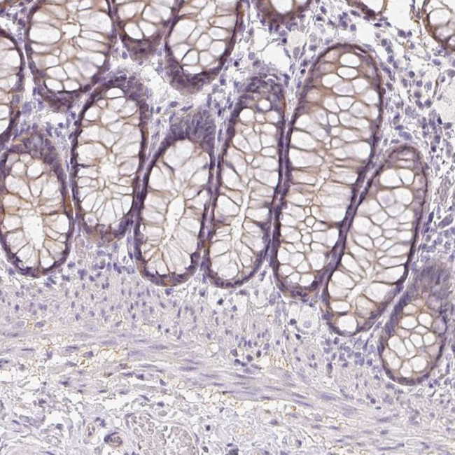 ZBBX Antibody in Immunohistochemistry (IHC)