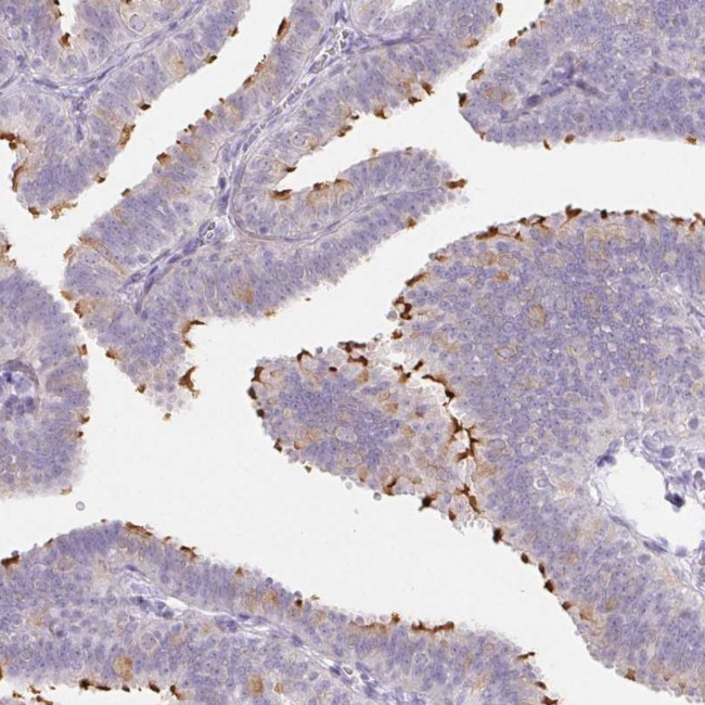 ZBBX Antibody in Immunohistochemistry (IHC)