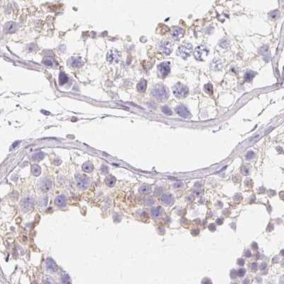 ZBBX Antibody in Immunohistochemistry (IHC)