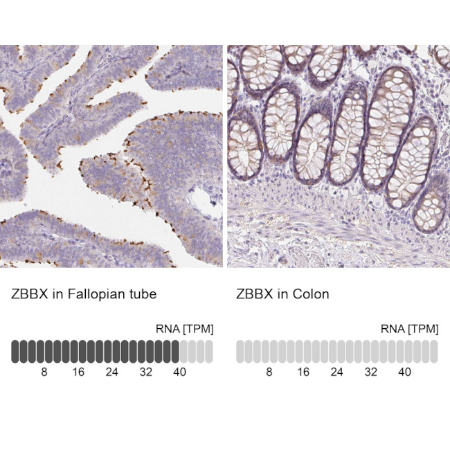 ZBBX Antibody