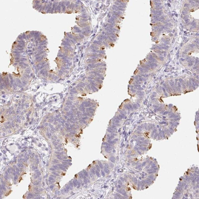 ZBBX Antibody in Immunohistochemistry (IHC)