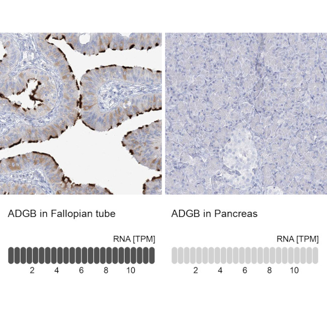 ADGB Antibody in Immunohistochemistry (IHC)