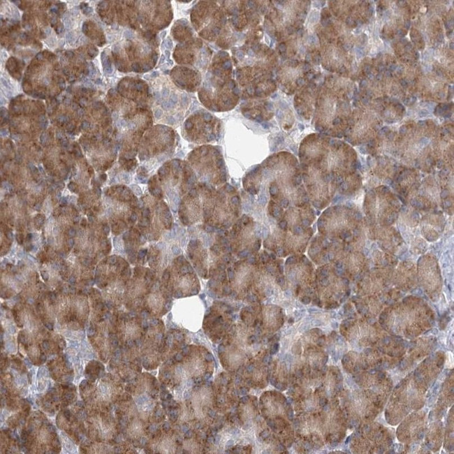 LACTB Antibody in Immunohistochemistry (IHC)