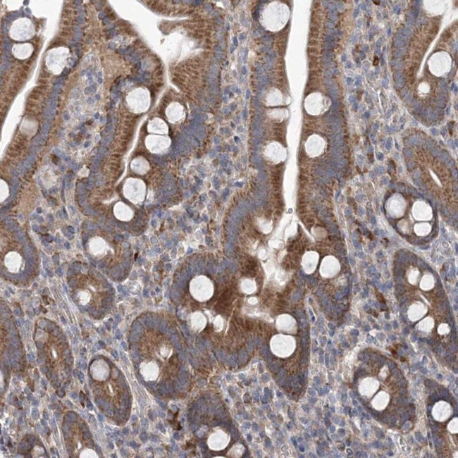 RF1ML Antibody in Immunohistochemistry (IHC)