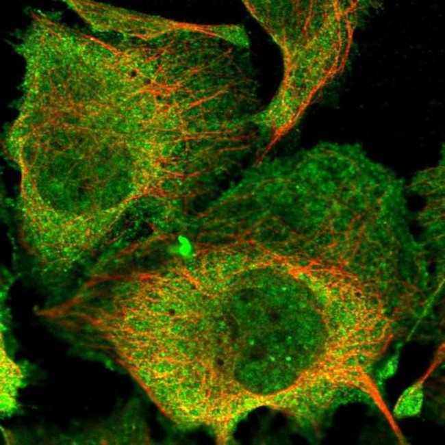 SPT6 Antibody in Immunocytochemistry (ICC/IF)