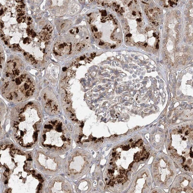 OBSL1 Antibody in Immunohistochemistry (IHC)