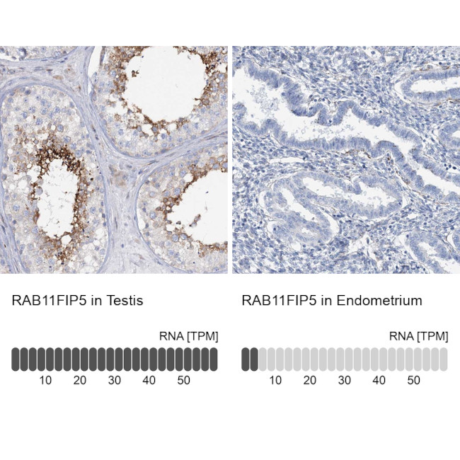 RAB11FIP5 Antibody in Immunohistochemistry (IHC)