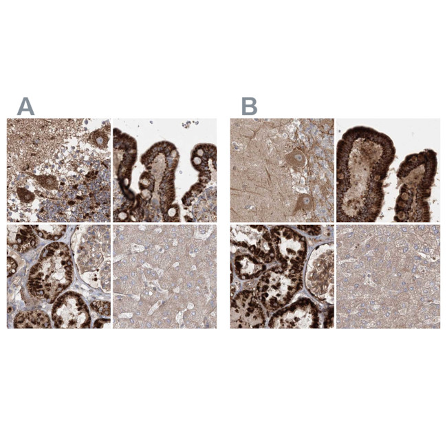 LRP130 Antibody in Immunohistochemistry (IHC)