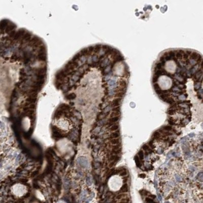 LRP130 Antibody in Immunohistochemistry (IHC)