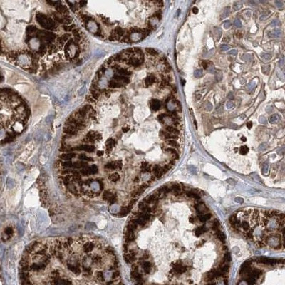 LRP130 Antibody in Immunohistochemistry (IHC)