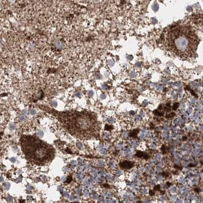 LRP130 Antibody in Immunohistochemistry (IHC)