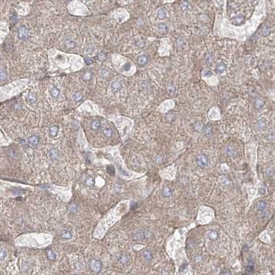 LRP130 Antibody in Immunohistochemistry (IHC)