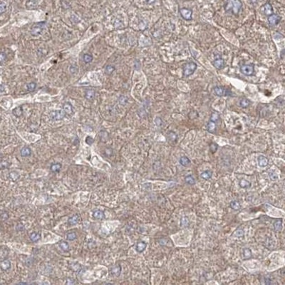 LRP130 Antibody in Immunohistochemistry (IHC)