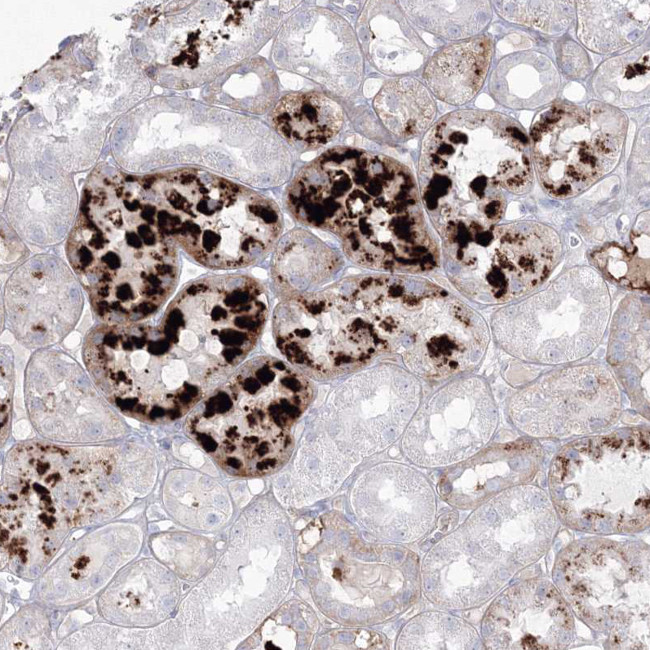 HYAL2 Antibody in Immunohistochemistry (IHC)